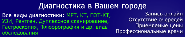 Варикоз — причины, симптомы и лечение варикозного расширения вен на ногах