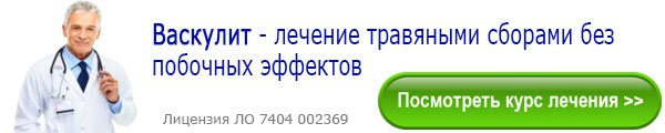 Васкулит – симптомы, причины, виды и лечение васкулита