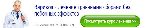 Варикоз — причины, симптомы и лечение варикозного расширения вен на ногах